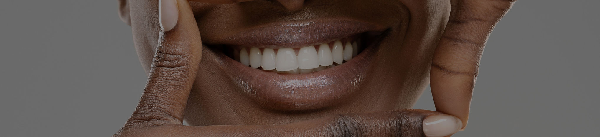 Smile Check_edited.jpg