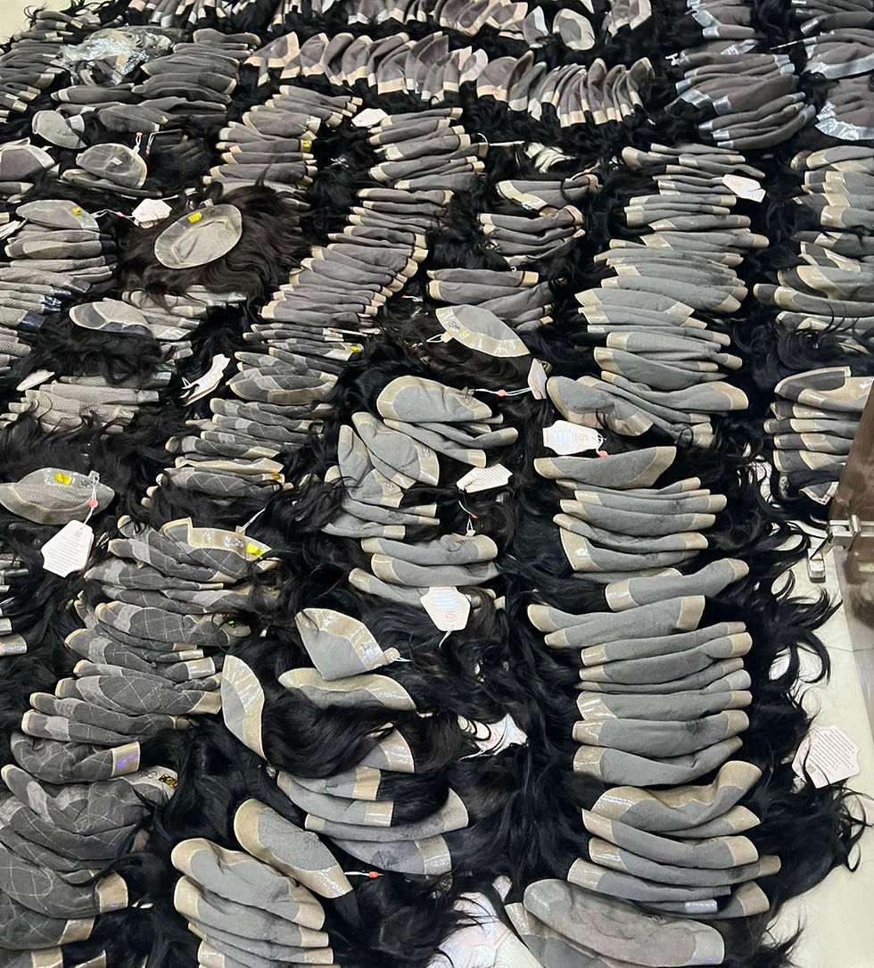 Top Reasons Hair Patches Are Replacing Hair Transplants