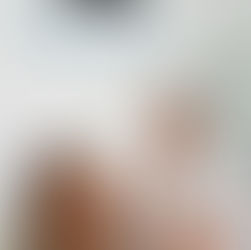 Analisi professionale della pelle per costruire un percorso estetico personalizzato e consapevole