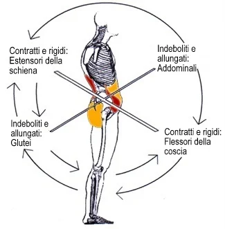 Muscoli contratti e postura 