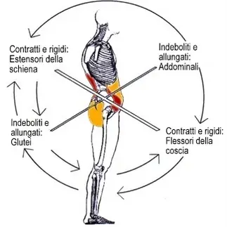 Muscoli contratti e postura
