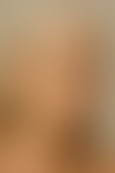 Primo piano di una donna matura con rughe sottili sul viso, simbolo del naturale invecchiamento cutaneo e della perdita di collagene.