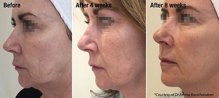 DR EMMA RAVICHANDRAN - SIDE.jpg