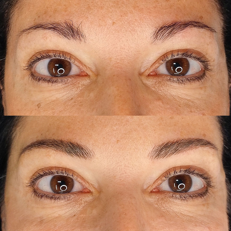 AVANT / APRÈS IMMÉDIAT