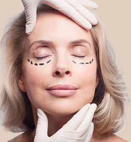 Transposition de gras