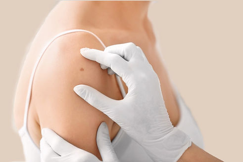 chirurgies mineures de la peau