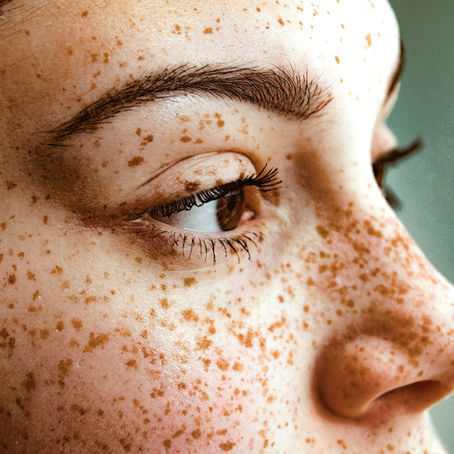 Rhinoplastie : tout comprendre sur la chirurgie esthétique du nez