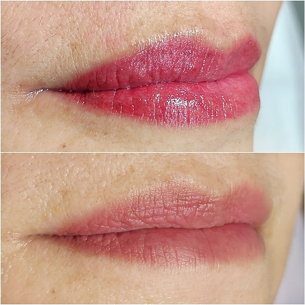 Micropigmentation des lèvres