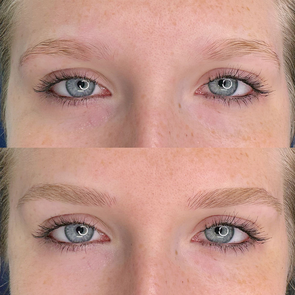 AVANT / APRÈS IMMÉDIAT