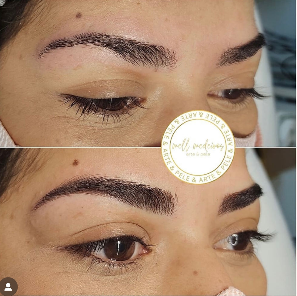 AVANT / APRÈS IMMÉDIAT