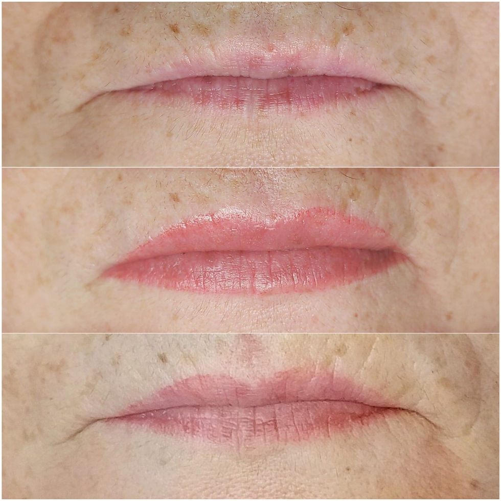 Micropigmentation des lèvres