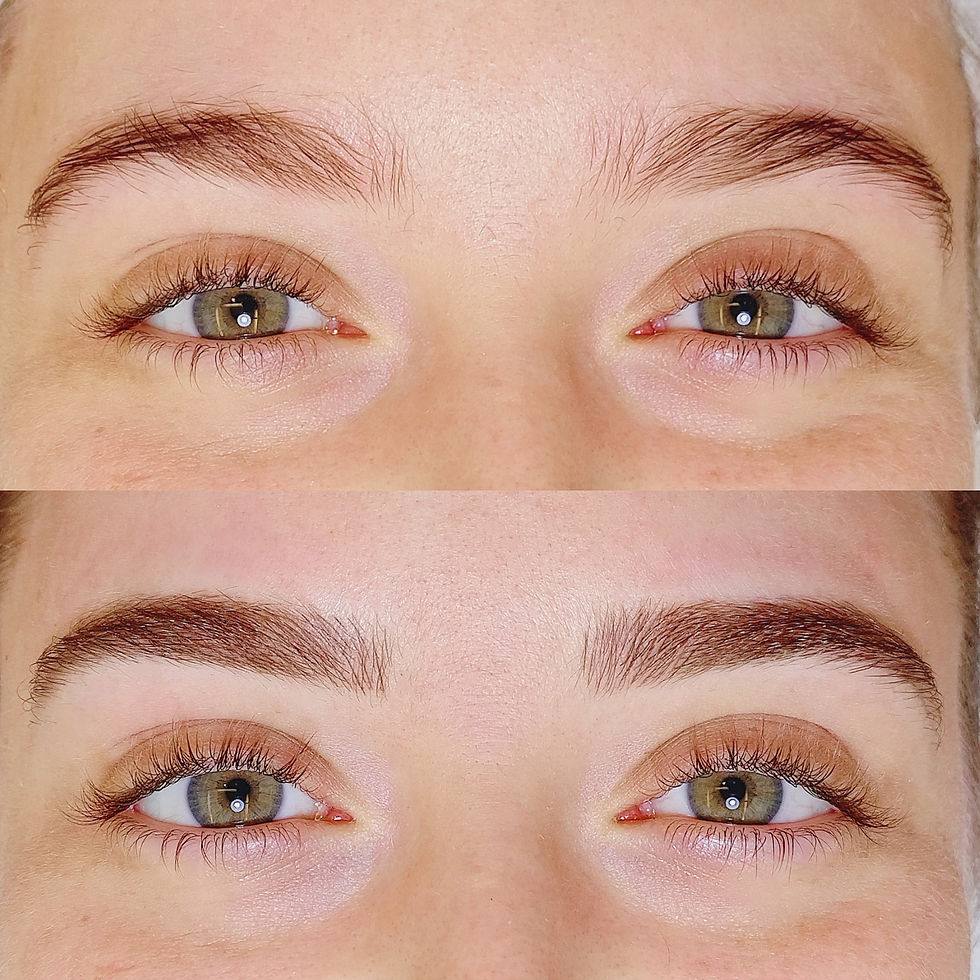 AVANT / APRÈS IMMÉDIAT