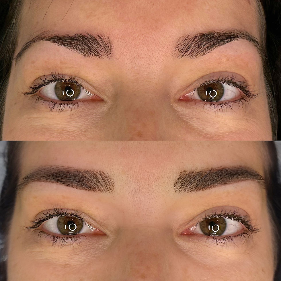 AVANT / APRÈS IMMÉDIAT