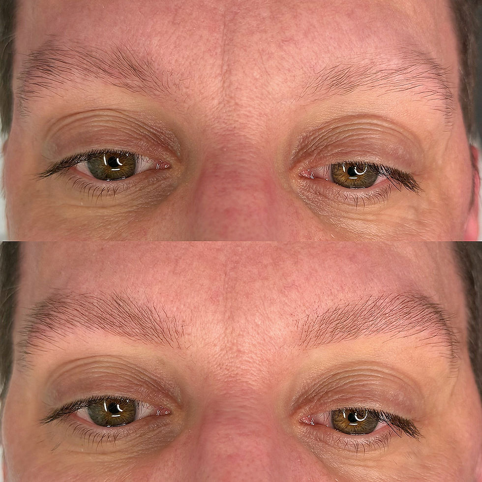 AVANT / APRÈS IMMÉDIAT