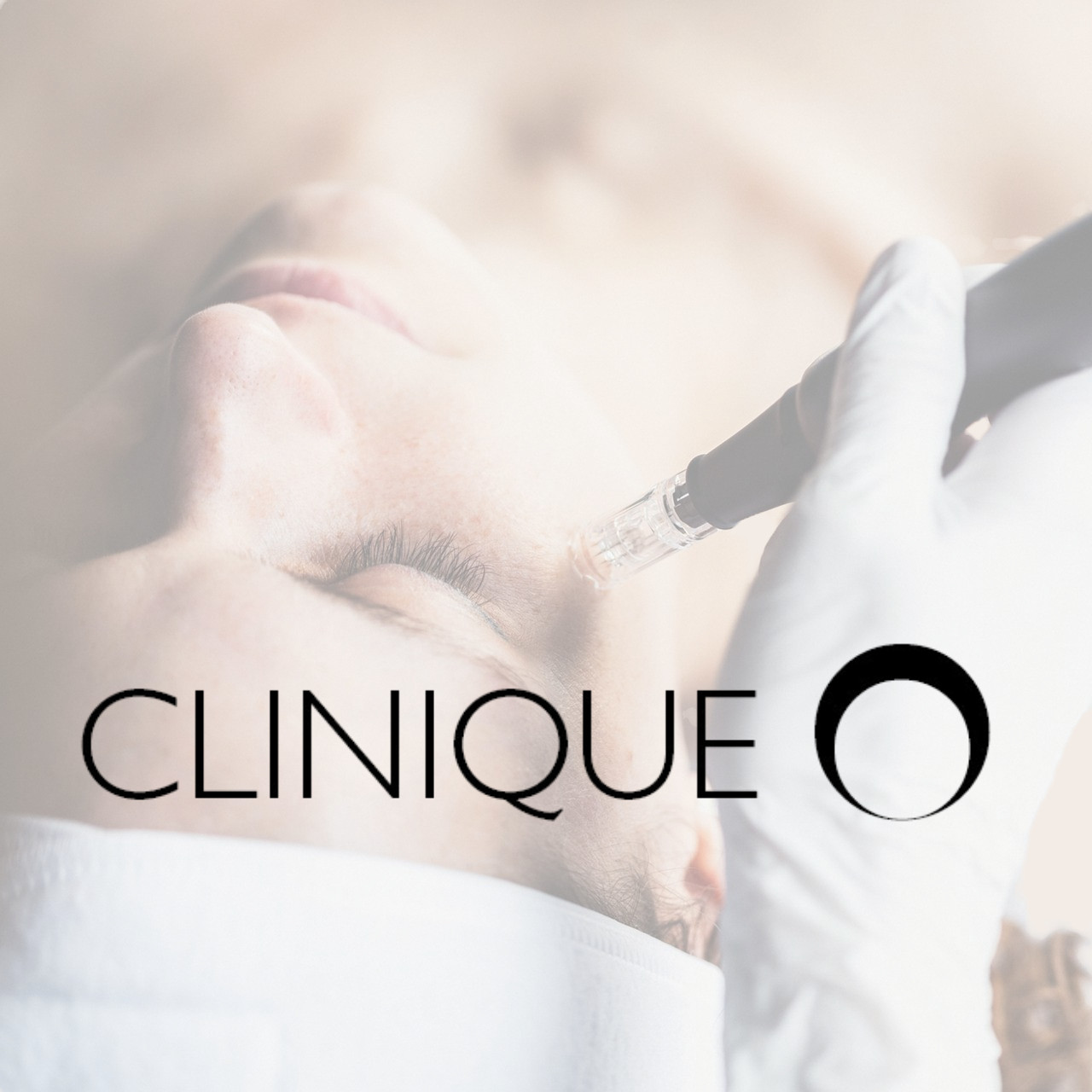 Microneedling | Clinique O - Traitements Esthétiques