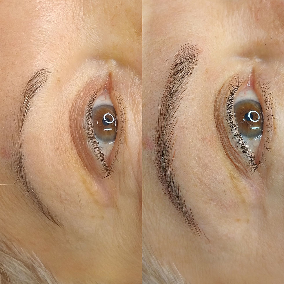 AVANT / APRÈS IMMÉDIAT