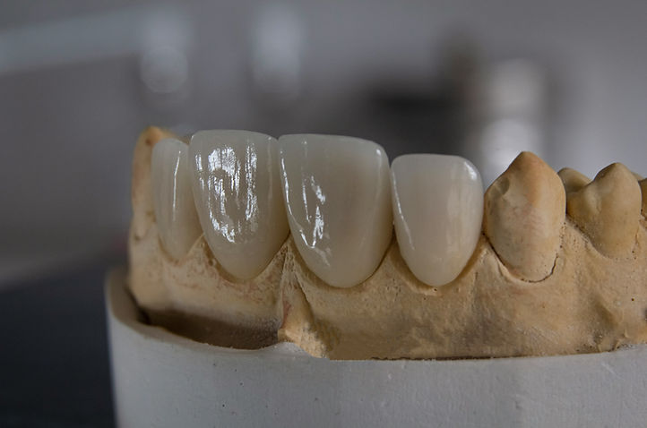 crown on model