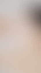 女士說明 半永久美妝-髮際線施途位置