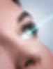 Lasik