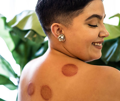 South-Florida-Acupuncture-Near-Me-Broward-Acupuncturist (1).jpg