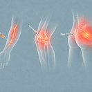 Dibujo de bloqueos e infiltraciones