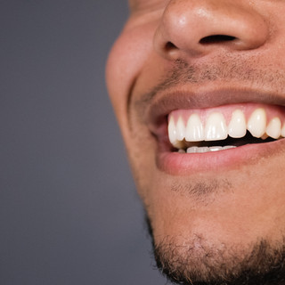 Composite bonding and white fillings