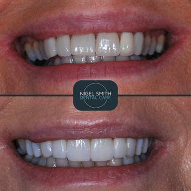 Untitled design (14).png