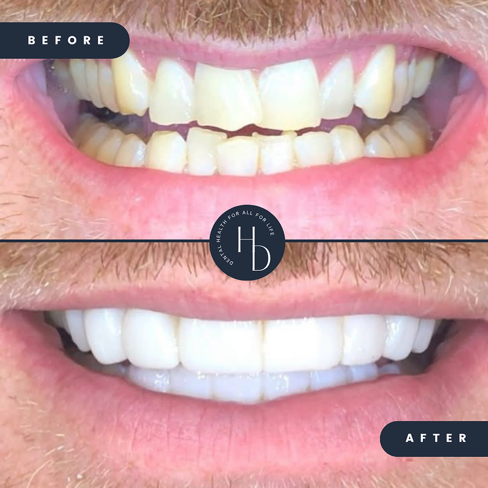 How Much Does a Smile Makeover Cost in Leicestershire? (And Why the Investment Is Only Part of the Story)