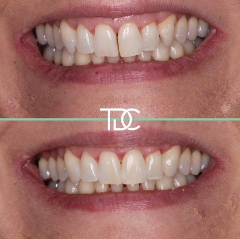 Screenshot 2022-11-23 at 15.15.36.png