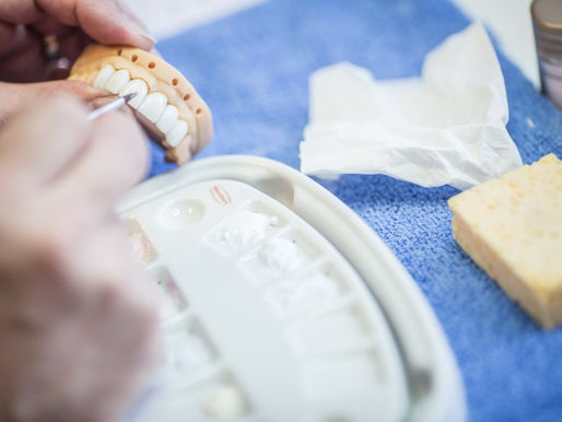 Our Seven-Step Guide for Getting Veneers