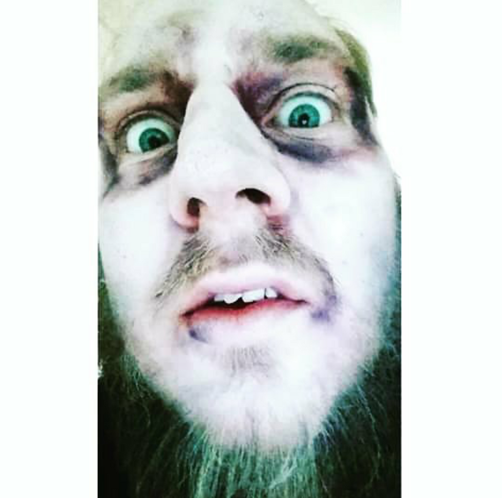 Decayed