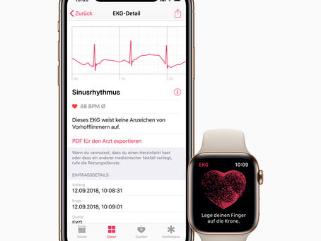 The New Apple Watch is a Lifesaver