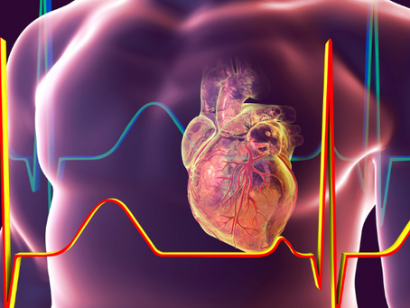 Estado deve realizar cateterismo em idoso que sofreu infarto