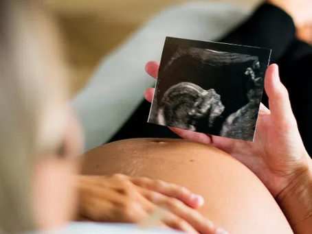 Operadora de saúde deve cobrir parto de urgência, mesmo que plano não preveja despesas obstétricas