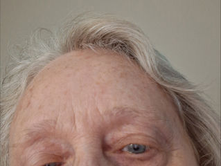 A New Wrinkle And A Droop