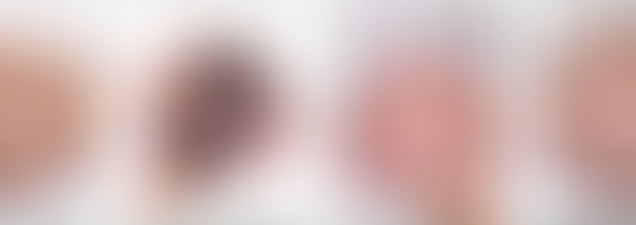 Como identificar que a cabeça do seu neném está assimétrica