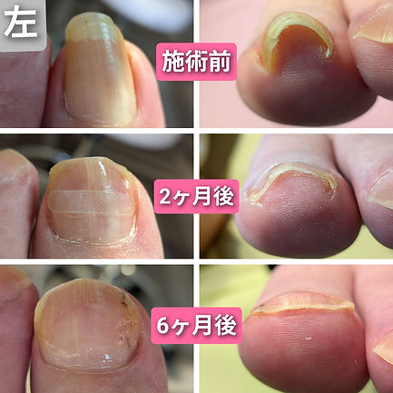 R8.5.3-8(左).jpg