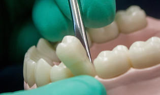 Extractions Regency Dental Practice Swanage Dorset