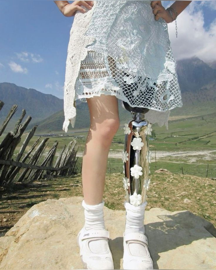 This beautifully detailed prosthesis proves that mobility and style can coexist. The floral embellishments and flowing crochet dress highlight how personal fashion choices can empower and elevate. You don’t have to hide your prosthesis—let it become part of your look.