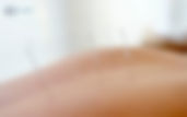 a section of back acupuncture of a patient.jpg