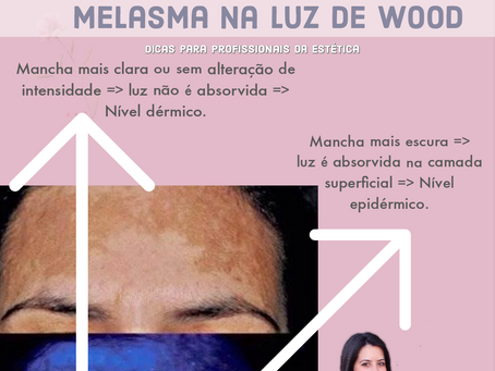 Melasma na Luz de Wood
