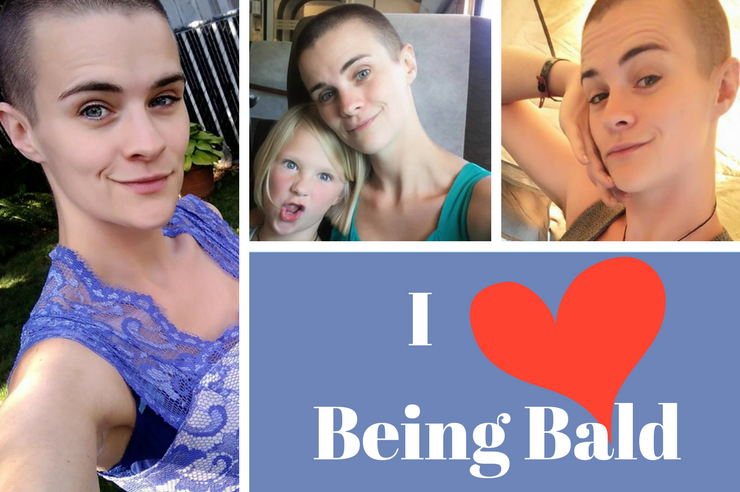 3 Reasons I Love Being A Bald Woman See more ideas about bald women, balding, bald hair. 3 reasons i love being a bald woman
