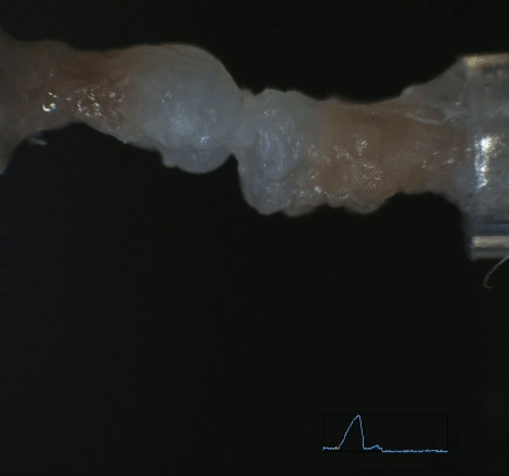 Gif P7 ACL Ramp (RIK).gif
