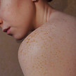 Freckled shoulder of a woman, emphasizing natural skin texture and beauty