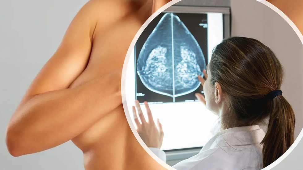 DCIS: should we stop calling it "breast cancer" - renewed calls to minimise the overdiagnosis and unnecessary treatment of breast abnormalities by Maryanne Demasi, PhD.