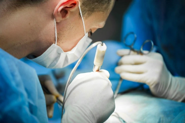 Cirurgia De Fimose Em Bh O Que E Como Tratar E Quando A Cirurgia E Necessaria