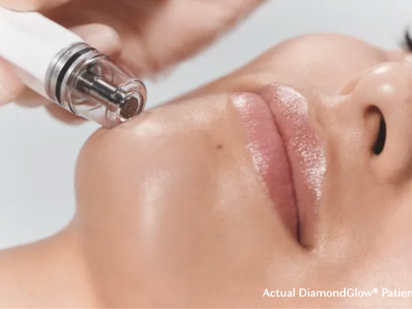 First, Dermaplaning. Next Up, DiamondGlow!