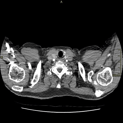 axial soft tissue.gif