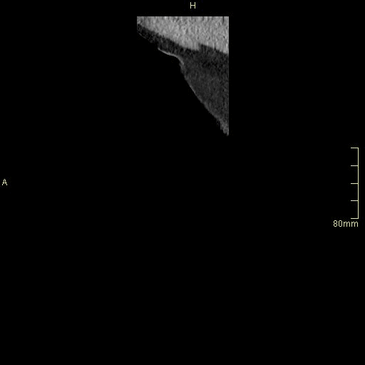 sagittal.gif