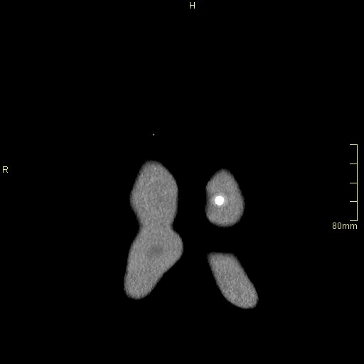coronal soft.gif
